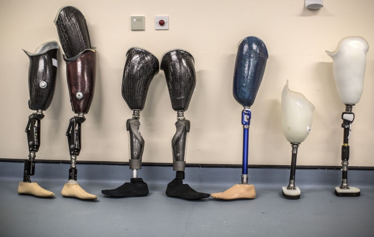 Orthèse, attelle ou prothèse : quelles différences ?