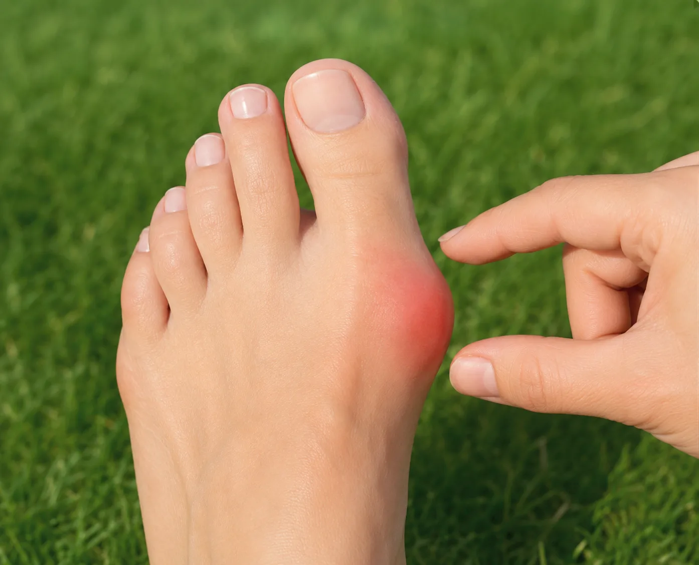 Hallux valgus : que faire ?